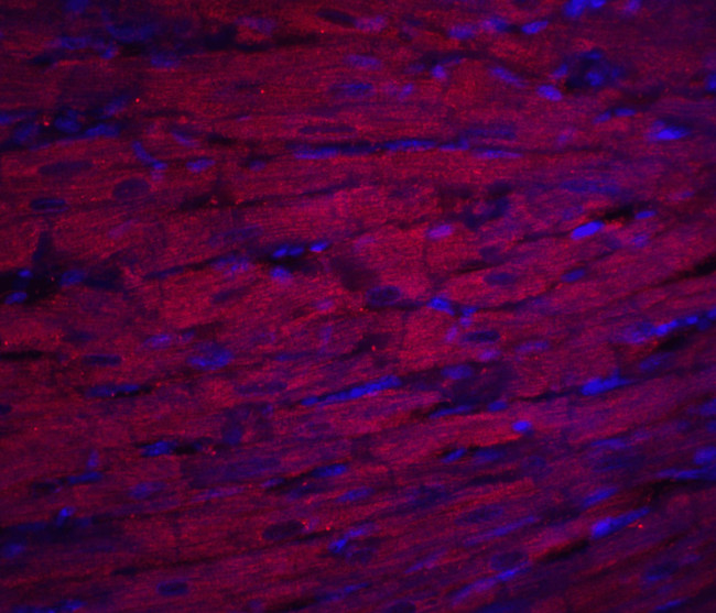 ASAH1 Antibody in Immunohistochemistry (IHC)