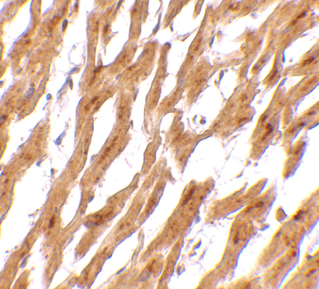 ASAH1 Antibody in Immunohistochemistry (IHC)