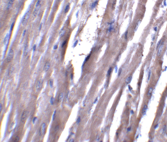 ASAH1 Antibody in Immunohistochemistry (IHC)