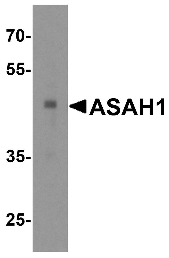 ASAH1 Antibody in Western Blot (WB)