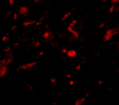 NENF Antibody in Immunohistochemistry (IHC)