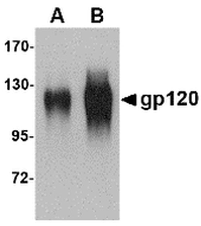 HIV1 gp120 Antibody in Western Blot (WB)