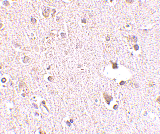 POLR3F Antibody in Immunohistochemistry (IHC)