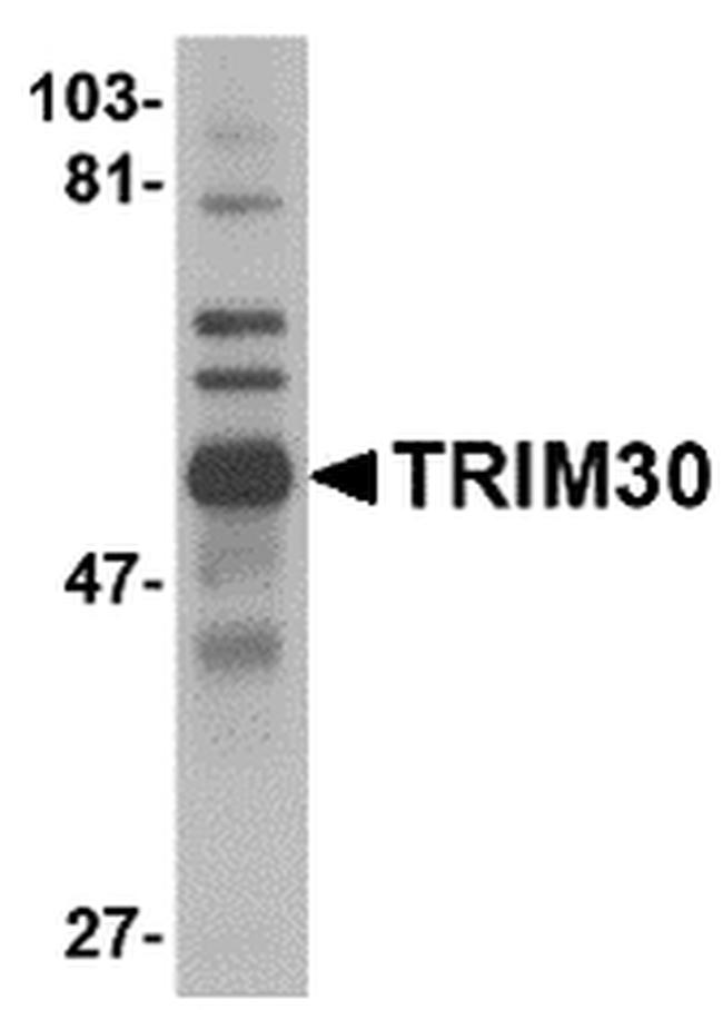 TRIM30 Antibody in Western Blot (WB)