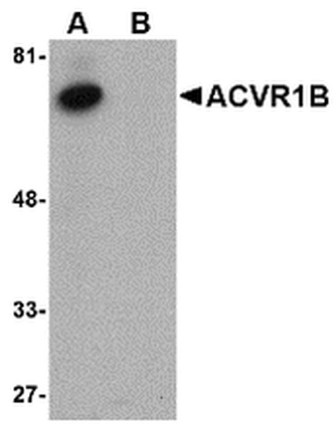 ACVR1B Antibody in Western Blot (WB)