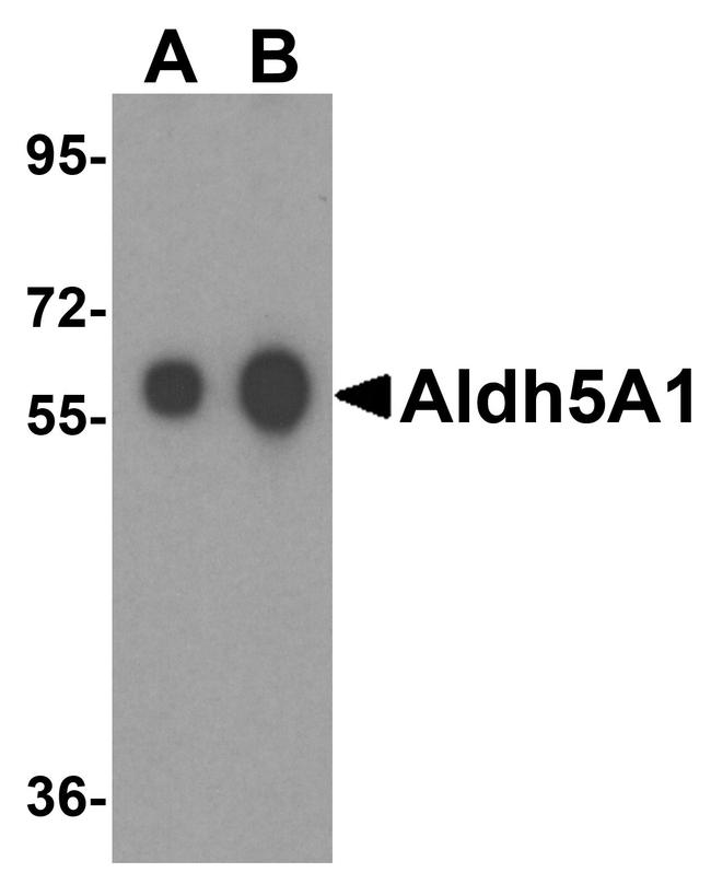 ALDH5A1 Antibody in Western Blot (WB)