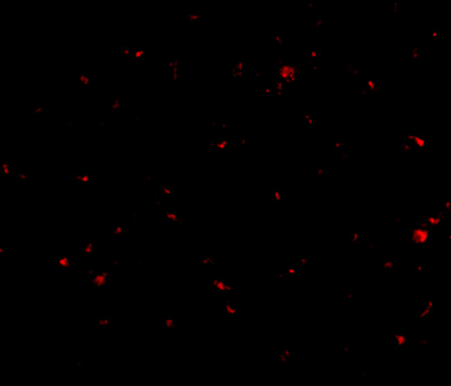 AAK1 Antibody in Immunohistochemistry (IHC)