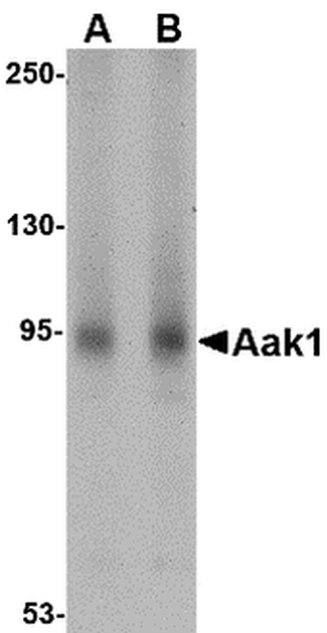 AAK1 Antibody in Western Blot (WB)