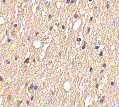 SPRED1 Antibody in Immunohistochemistry (IHC)