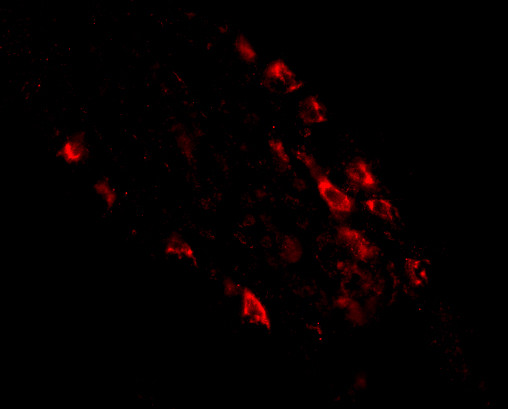 RKHD1 Antibody in Immunohistochemistry (IHC)