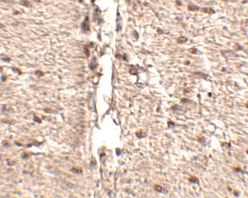 RKHD1 Antibody in Immunohistochemistry (IHC)