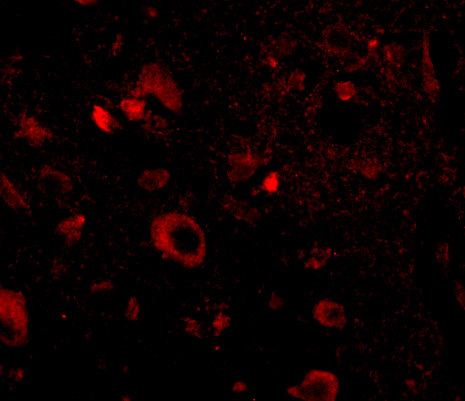 AIPL1 Antibody in Immunohistochemistry (IHC)