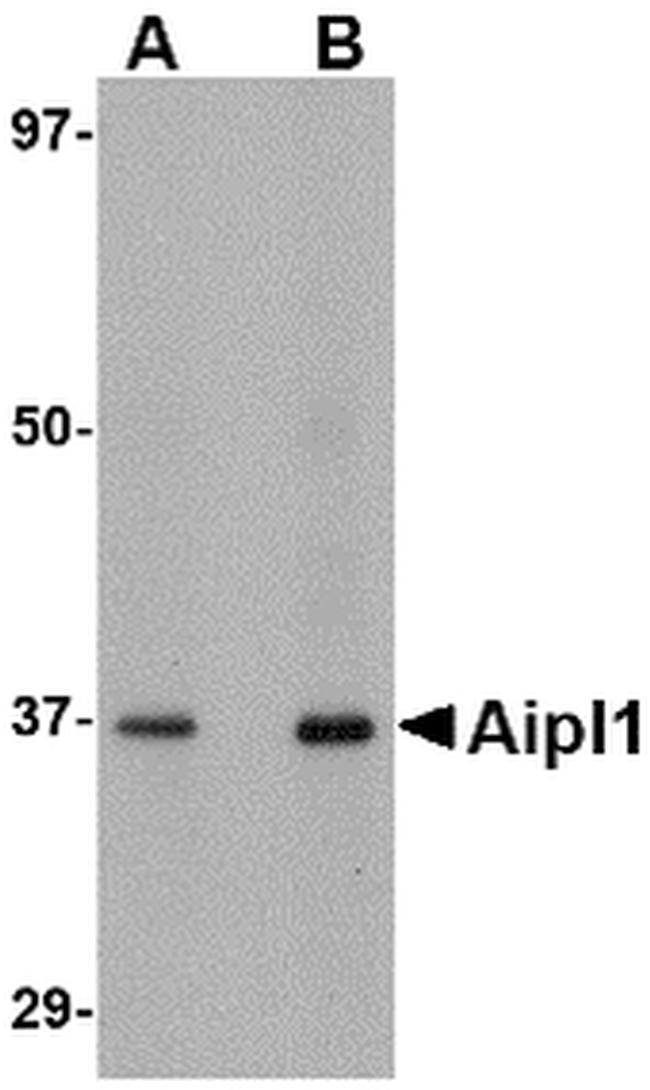 AIPL1 Antibody in Western Blot (WB)