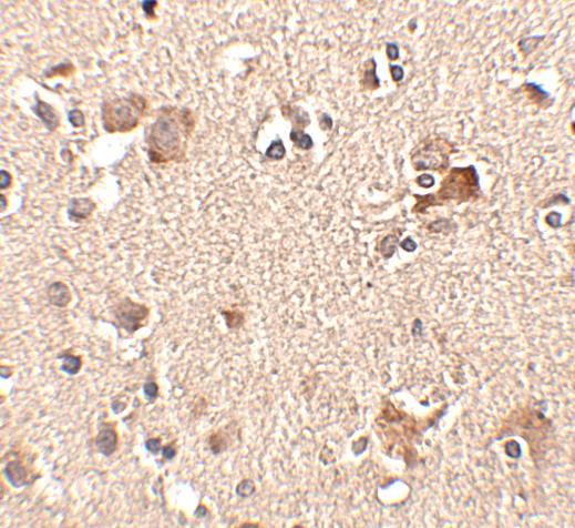 AIPL1 Antibody in Immunohistochemistry (IHC)