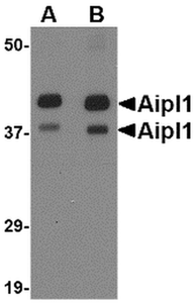 AIPL1 Antibody in Western Blot (WB)