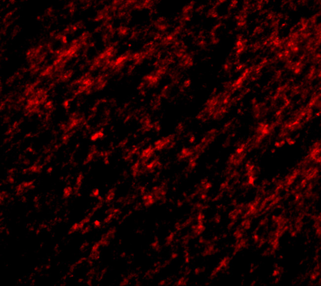 STK39 Antibody in Immunohistochemistry (IHC)