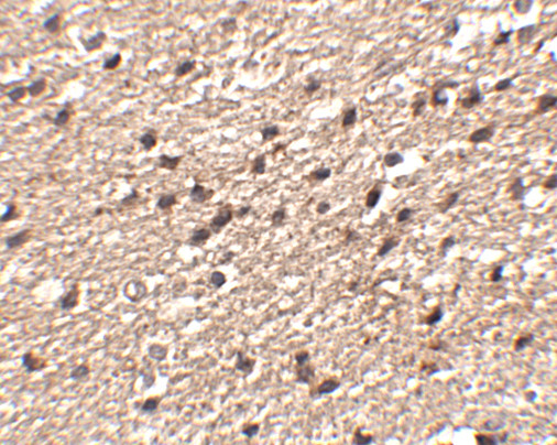 STK39 Antibody in Immunohistochemistry (IHC)