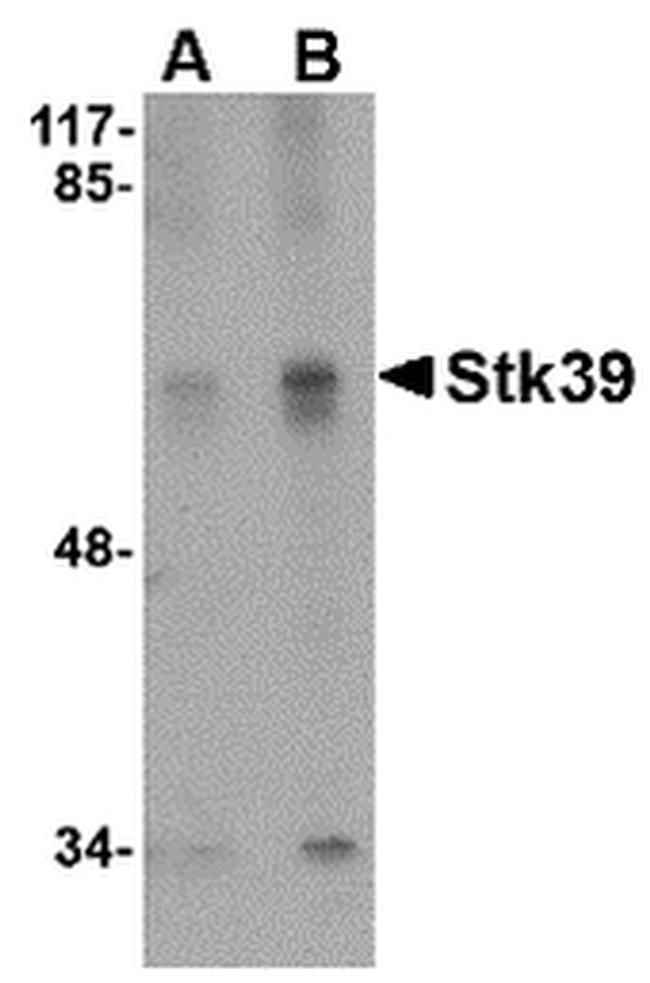 STK39 Antibody in Western Blot (WB)