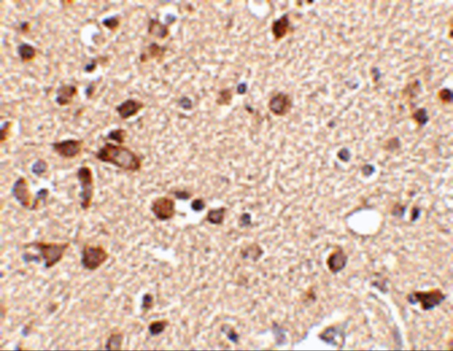 STK39 Antibody in Immunohistochemistry (IHC)