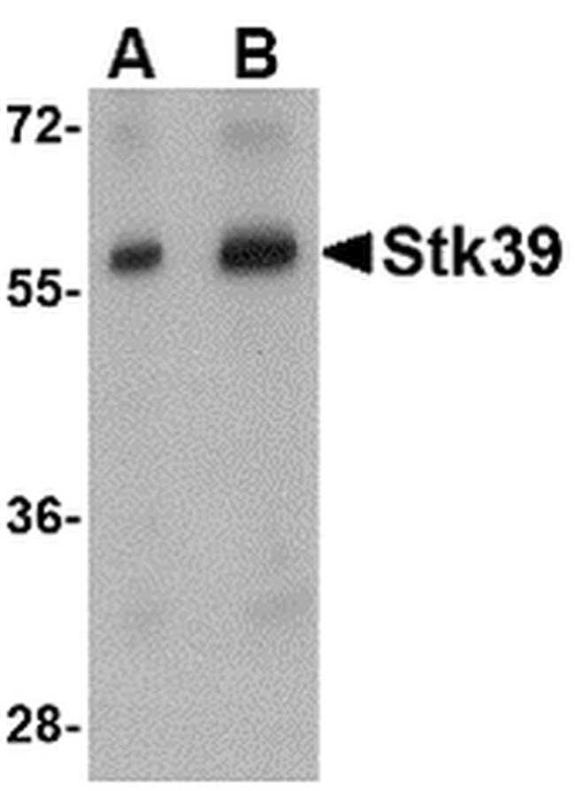 STK39 Antibody in Western Blot (WB)