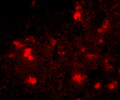 DACT2 Antibody in Immunocytochemistry (ICC/IF)