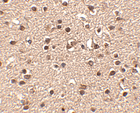 DACT2 Antibody in Immunohistochemistry (IHC)