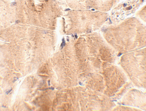 JPH2 Antibody in Immunohistochemistry (IHC)