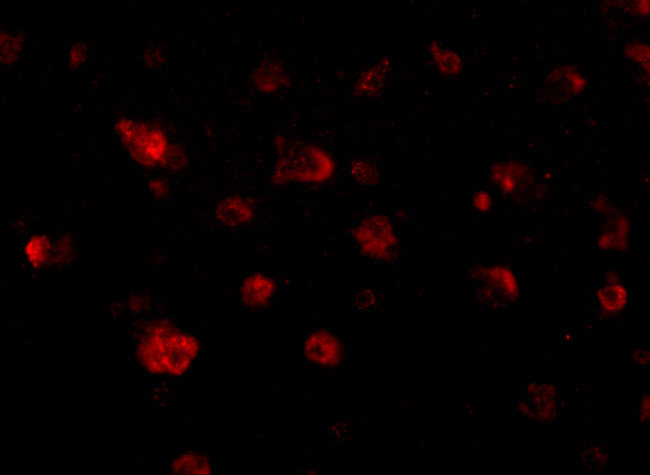 JPH3 Antibody in Immunohistochemistry (IHC)