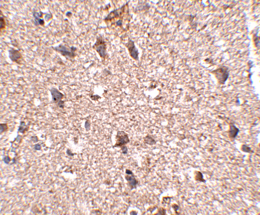 JPH3 Antibody in Immunohistochemistry (IHC)