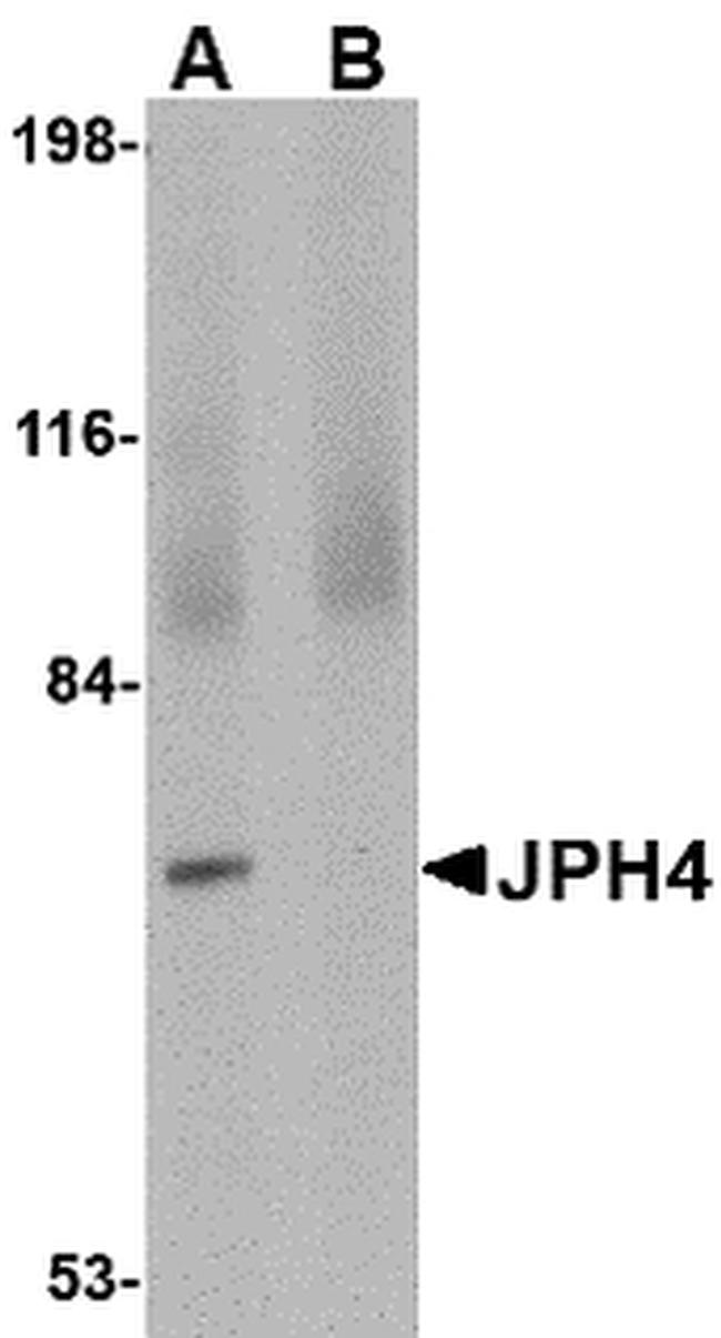 JPH4 Antibody in Western Blot (WB)