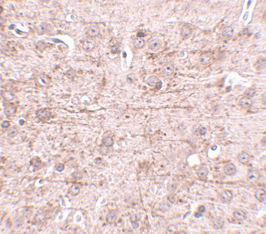 ZBTB1 Antibody in Immunohistochemistry (IHC)