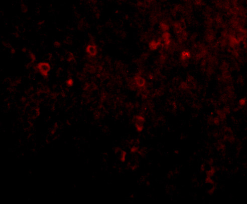 EBI3 Antibody in Immunohistochemistry (PFA fixed) (IHC (PFA))