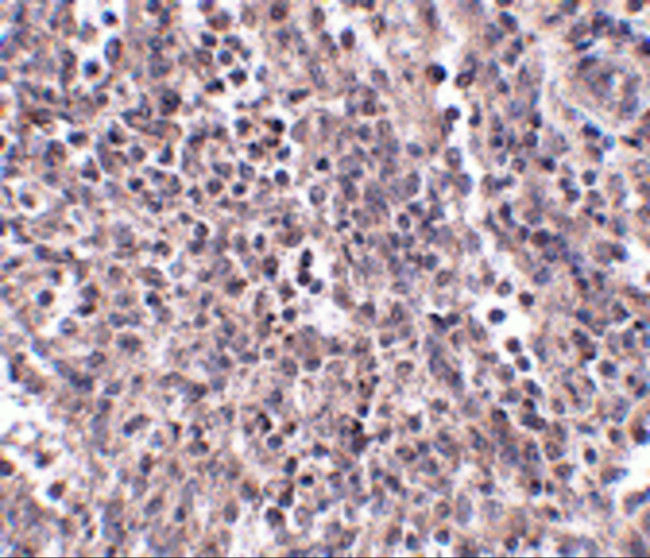 EBI3 Antibody in Immunohistochemistry (Paraffin) (IHC (P))