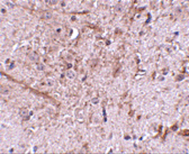 TOM70 Antibody in Immunohistochemistry (Paraffin) (IHC (P))