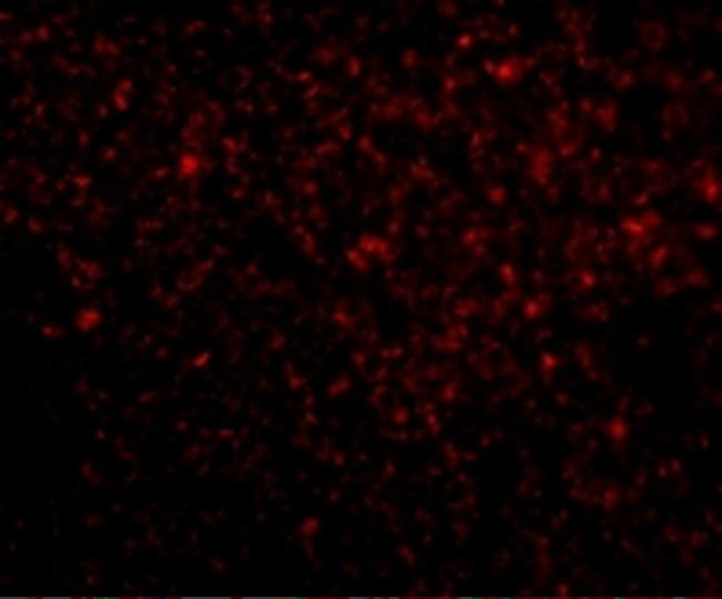 TREX1 Antibody in Immunohistochemistry (IHC)