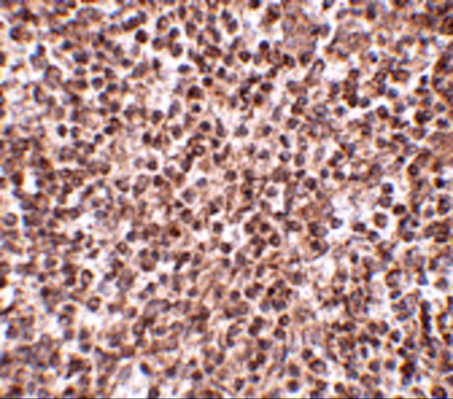 TREX1 Antibody in Immunohistochemistry (IHC)