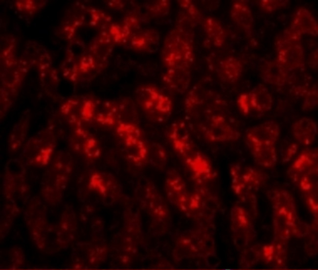 TREX2 Antibody in Immunocytochemistry (ICC/IF)