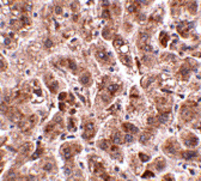 TREX2 Antibody in Immunohistochemistry (IHC)