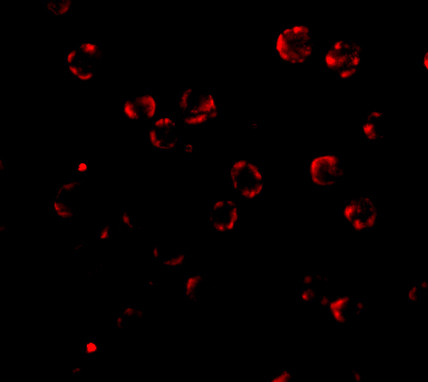 RNAse H2A Antibody in Immunocytochemistry (ICC/IF)