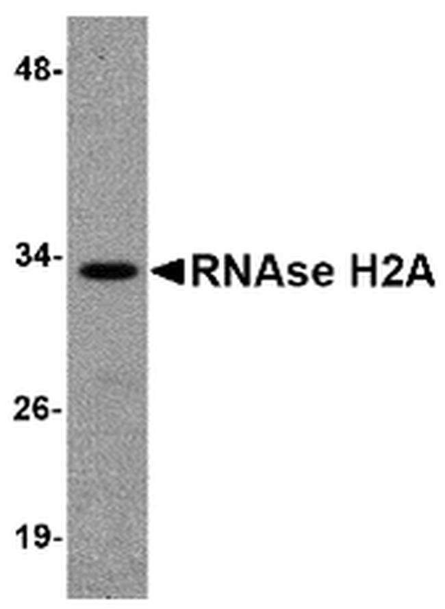 RNAse H2A Antibody in Western Blot (WB)