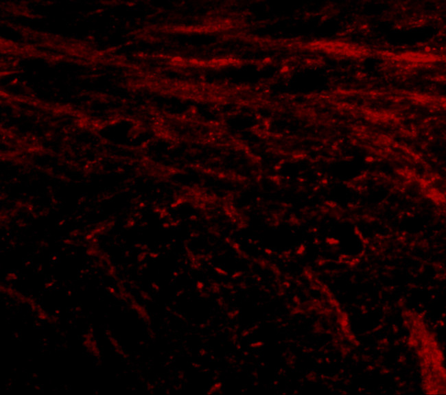 IL-16 Antibody in Immunohistochemistry (IHC)