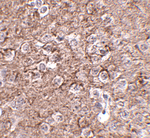 IL-16 Antibody in Immunohistochemistry (IHC)