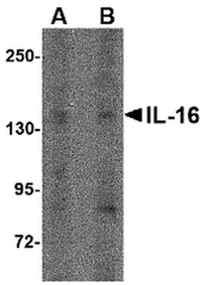 IL-16 Antibody in Western Blot (WB)
