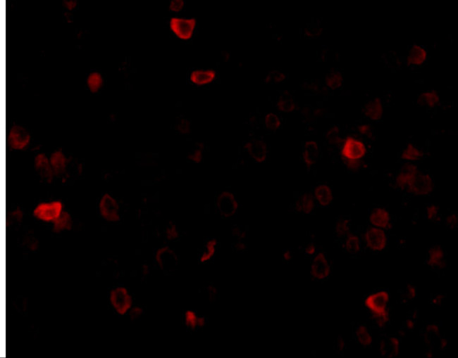 IL-16 Antibody in Immunohistochemistry (Paraffin) (IHC (P))