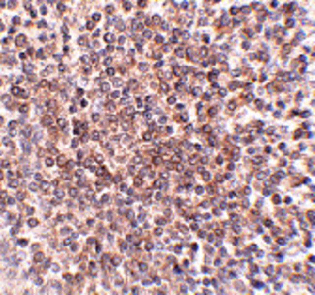 OCC1 Antibody in Immunohistochemistry (IHC)