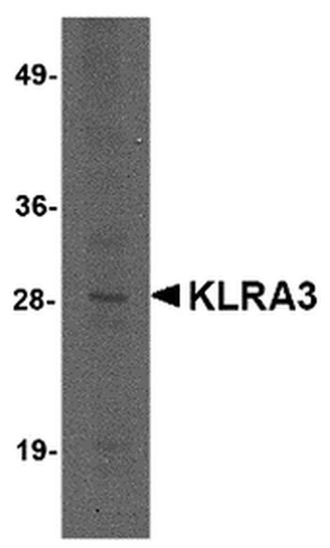 KLRA3 Antibody in Western Blot (WB)
