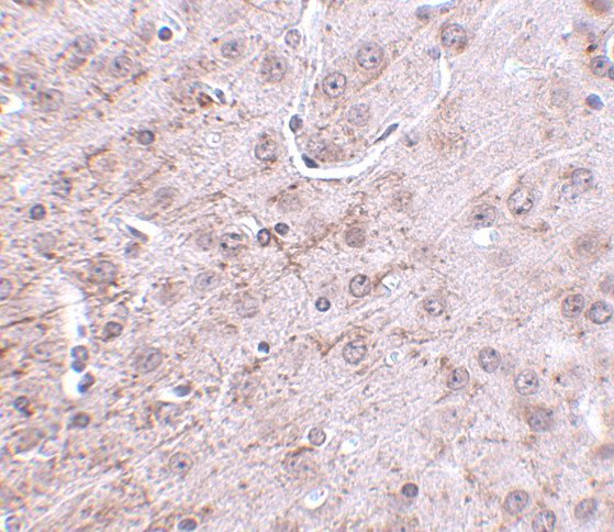 CRMP1 Antibody in Immunohistochemistry (IHC)