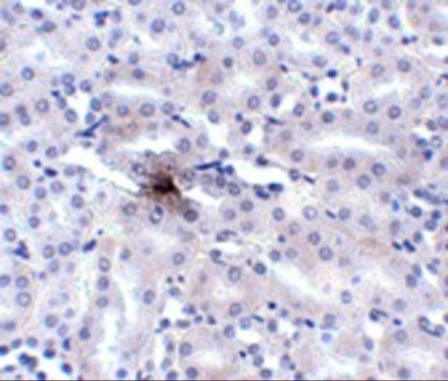 ZIP11 Antibody in Immunohistochemistry (IHC)