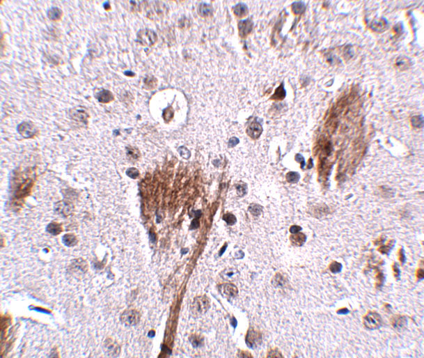 SPG11 Antibody in Immunohistochemistry (IHC)