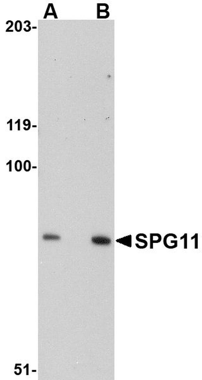 SPG11 Antibody in Western Blot (WB)